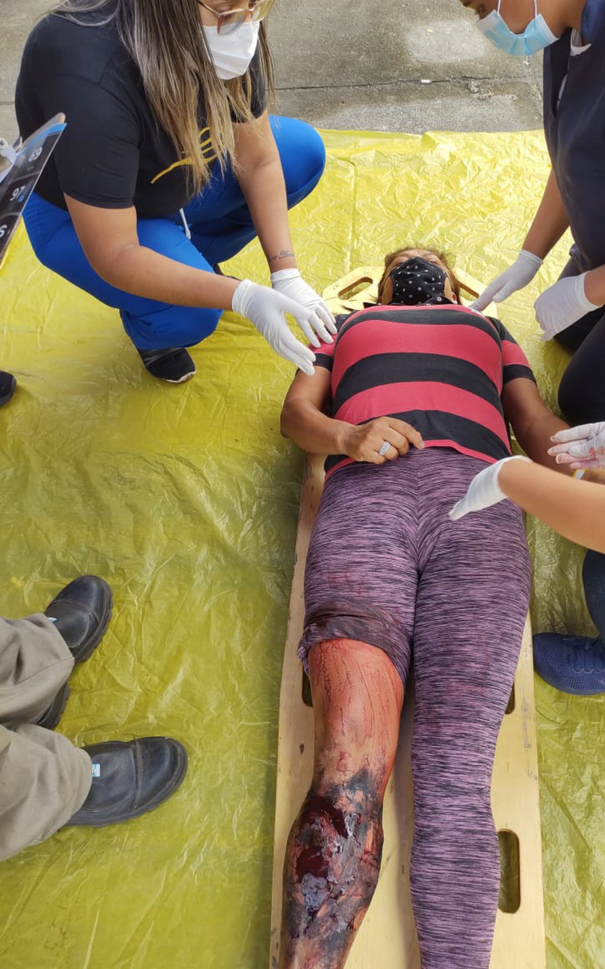 Hospital de Saracuruna realiza simulado de atropelamento - Divulga&ccedil;&atilde;o