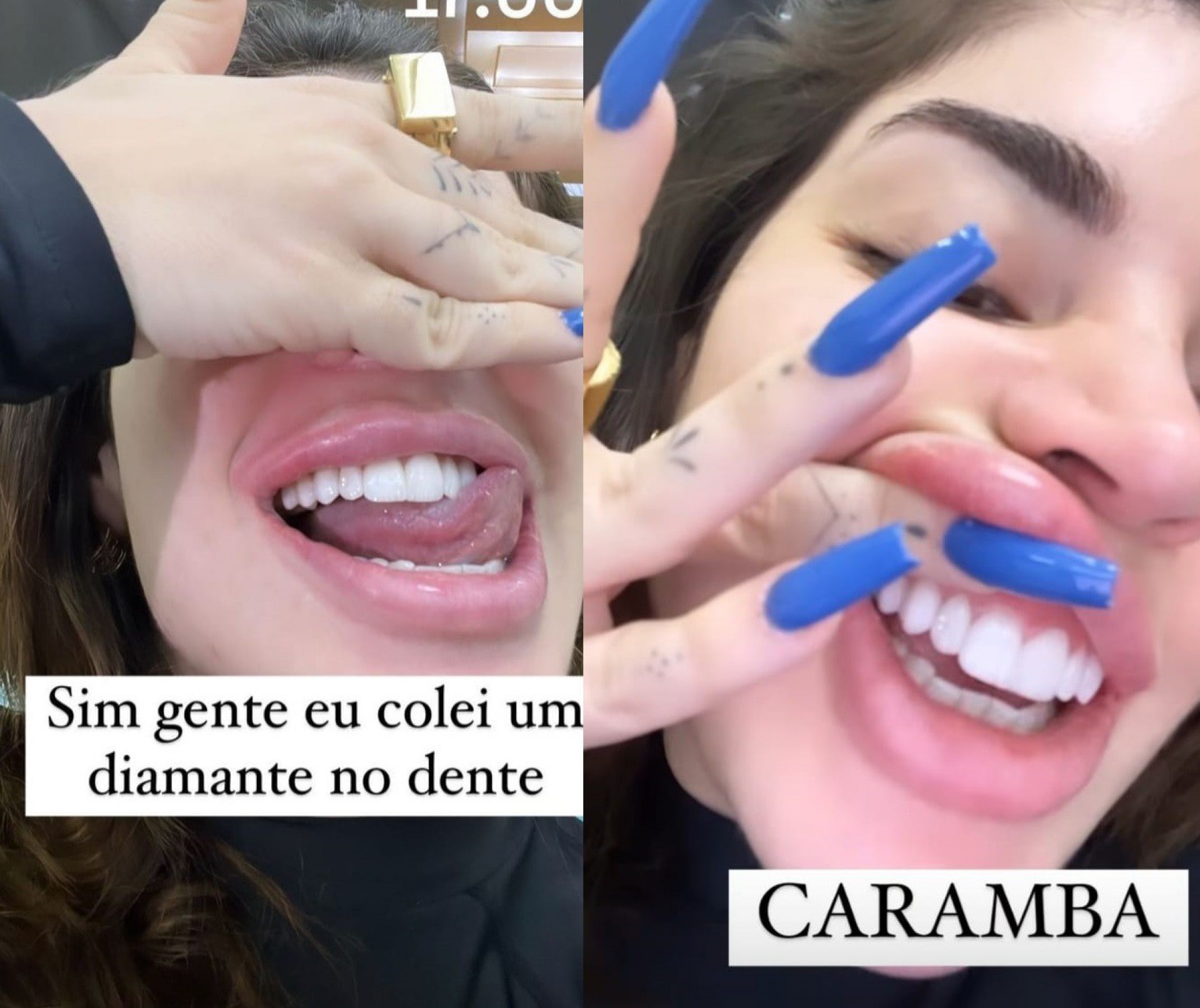 Gkay exibiu diamante que colocou no dente - Reprodução/Instagram