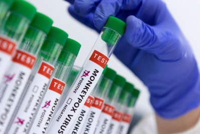 Brasil registra terceiro caso da varíola do macaco