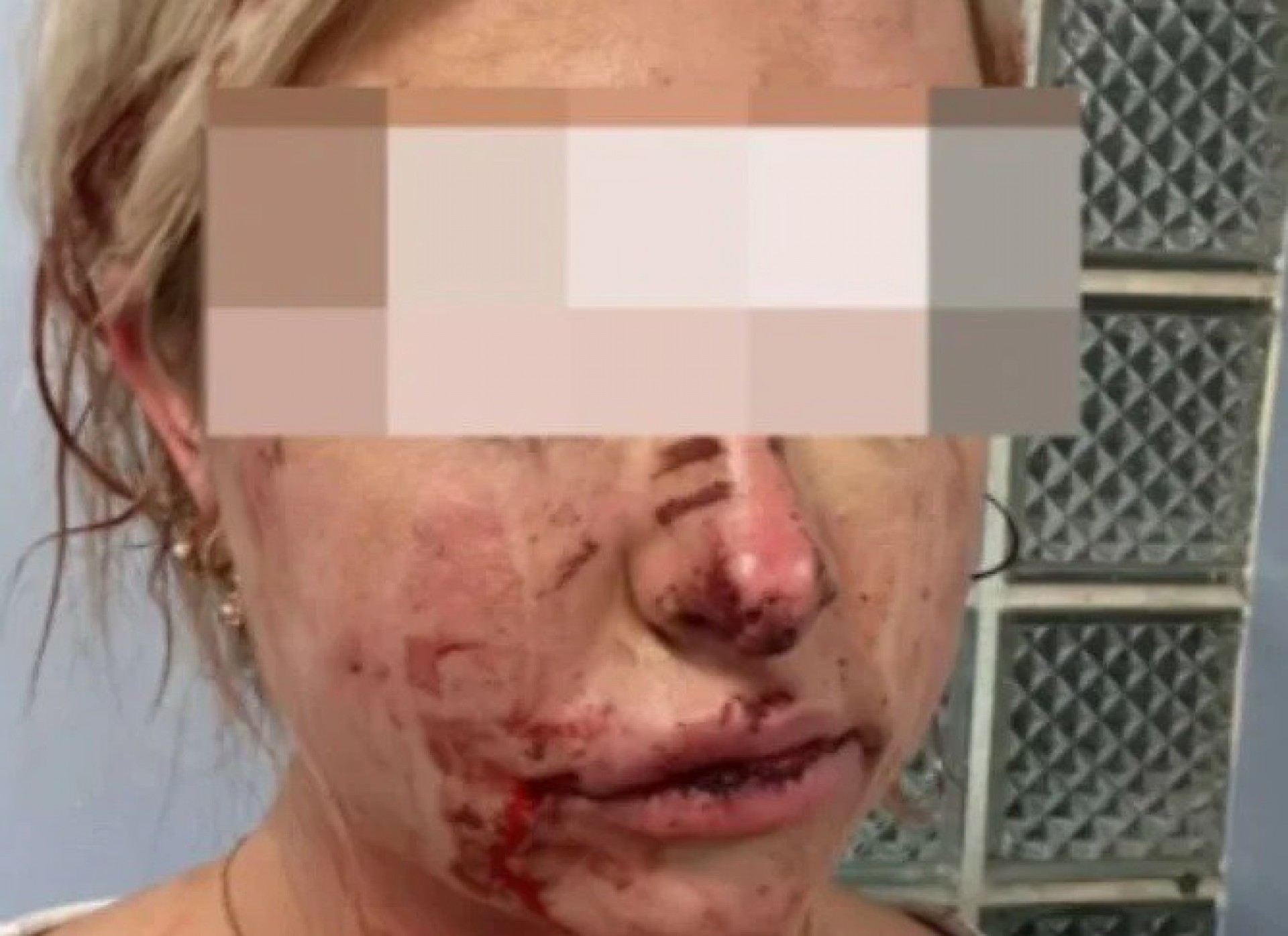 Wag Keeley Carter foi espancada por casal - Reprodu&ccedil;&atilde;o / Instagram 