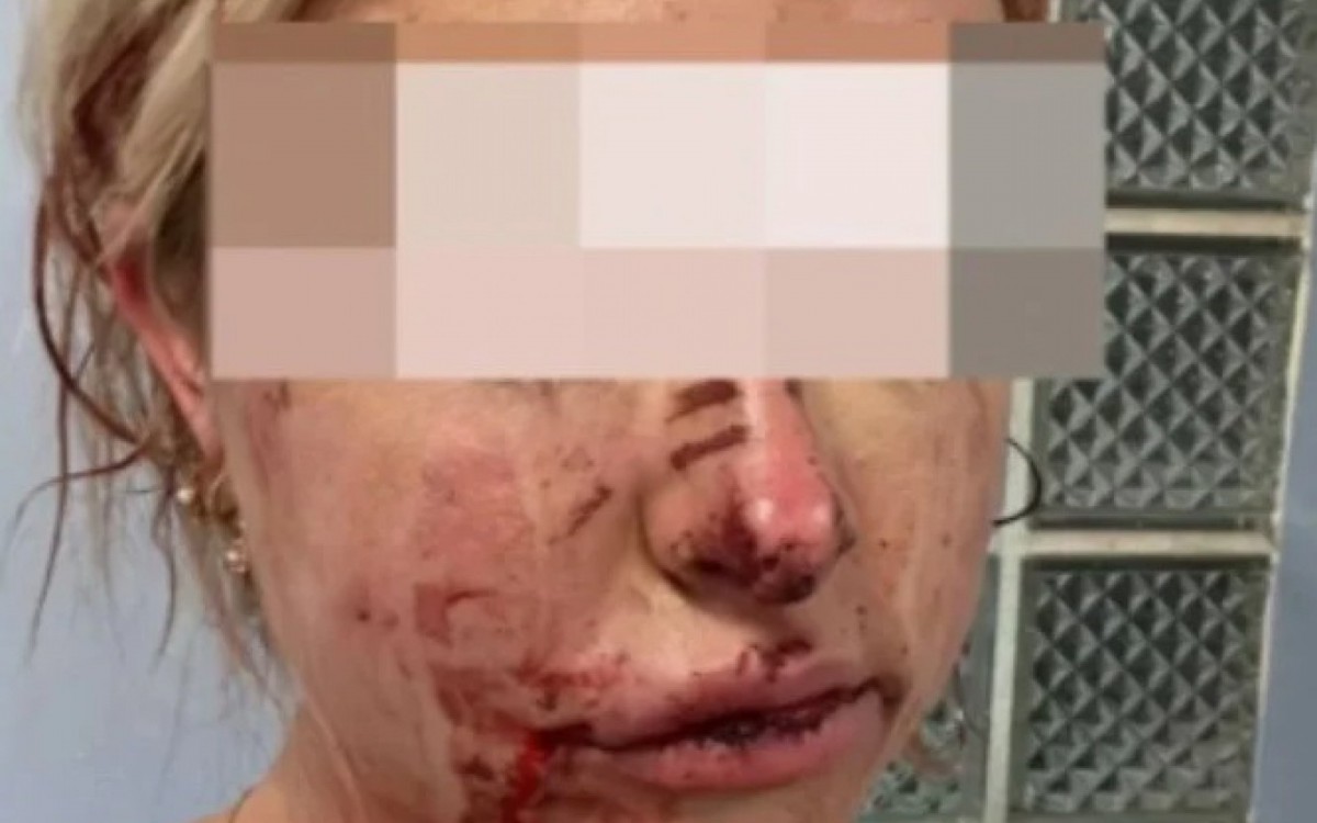 Wag Keeley Carter foi espancada por casal