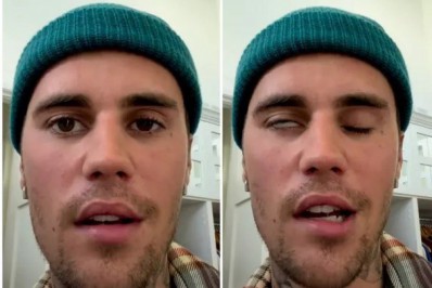 Justin Bieber desabafa após paralisia facial: 'Jesus está comigo'