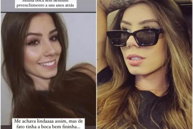 Maria Lina compartilha antes e depois de procedimento estético: 'Me sinto mais bonita'