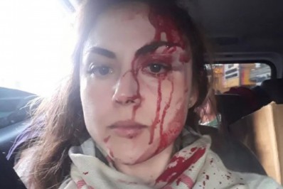 Ouvidor das Polícias de SP requisita a prisão temporária do agressor de procuradora