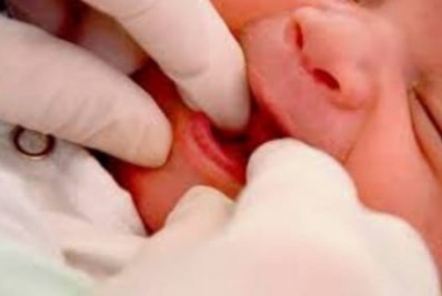 Dia Nacional do Teste da Linguinha: exame é obrigatório em recém-nascidos