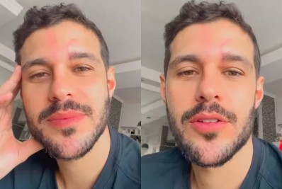 Rodrigo Mussi desabafa após ter problema no estômago: 'Fiquei de cama'