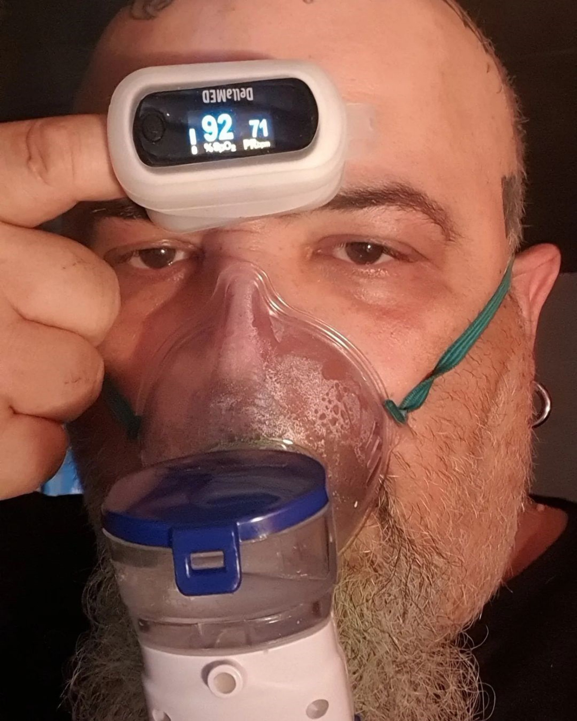 João Gordo post foto fazendo nebulização e preocupa amigos - Reprodução Internet