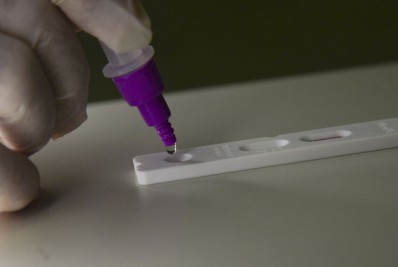 Fiocruz identifica subvariante BA.5.3.1 do coronavírus no Amazonas