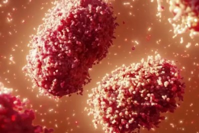 Estado do Rio tem 35 casos ativos de monkeypox