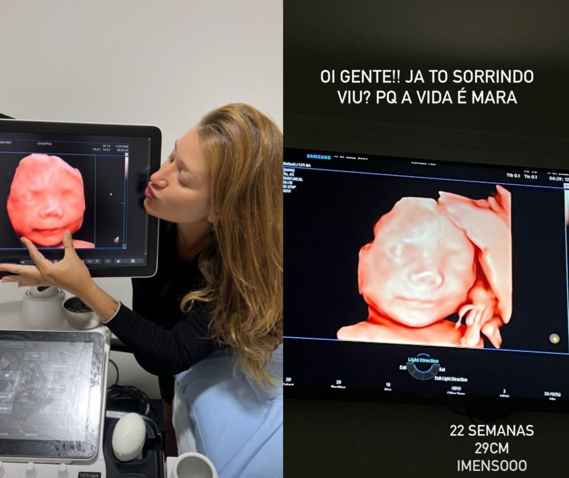 Gabriela Puigliesi exibiu o ultrassom do primeiro filho  - Reprodução/Instagram 