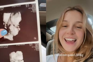 Isabella Scherer exibe ultrassom dos filhos gêmeos