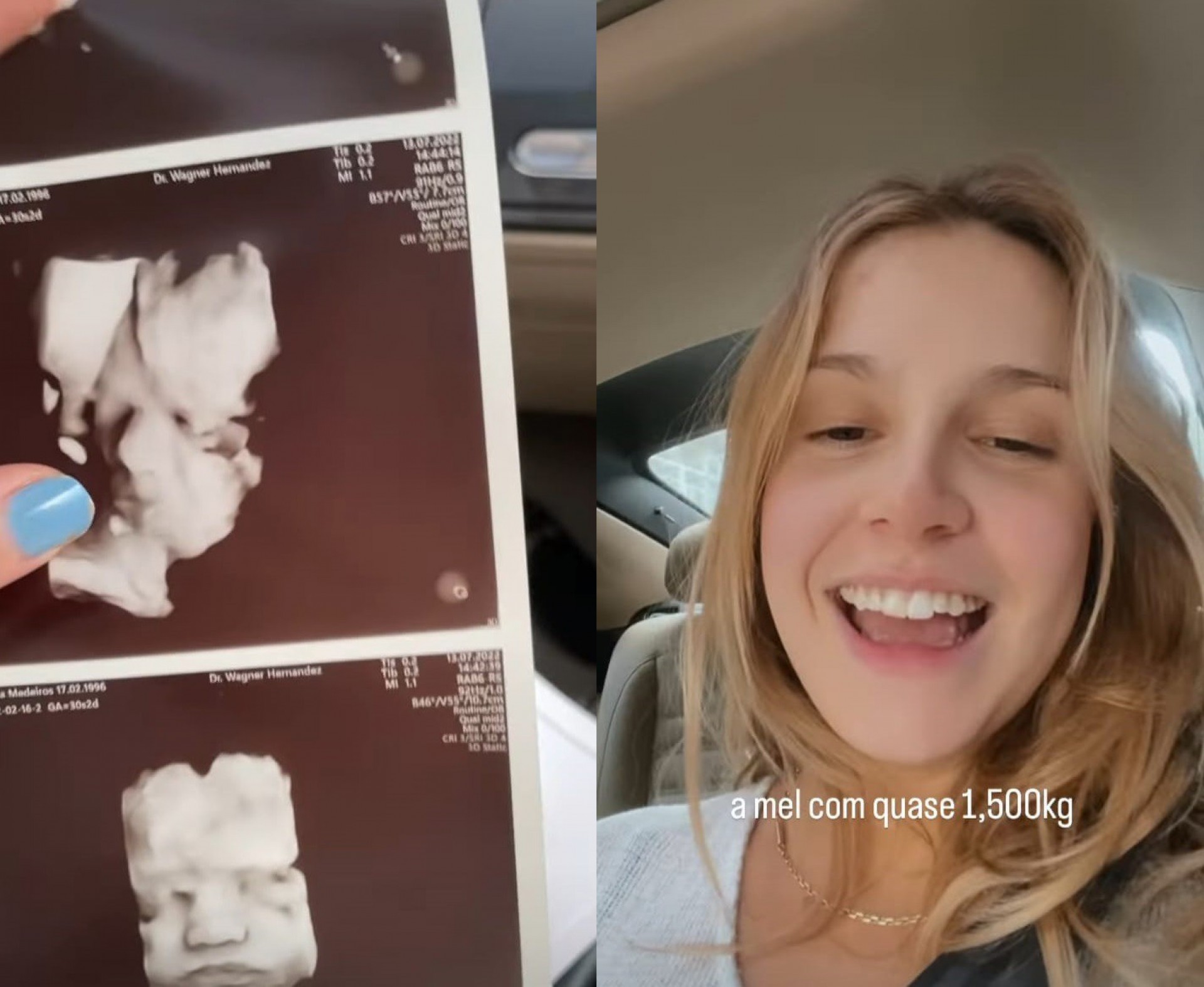 Isabella Scherer mostrou ultrassom dos filhos - Reprodução/Instagram