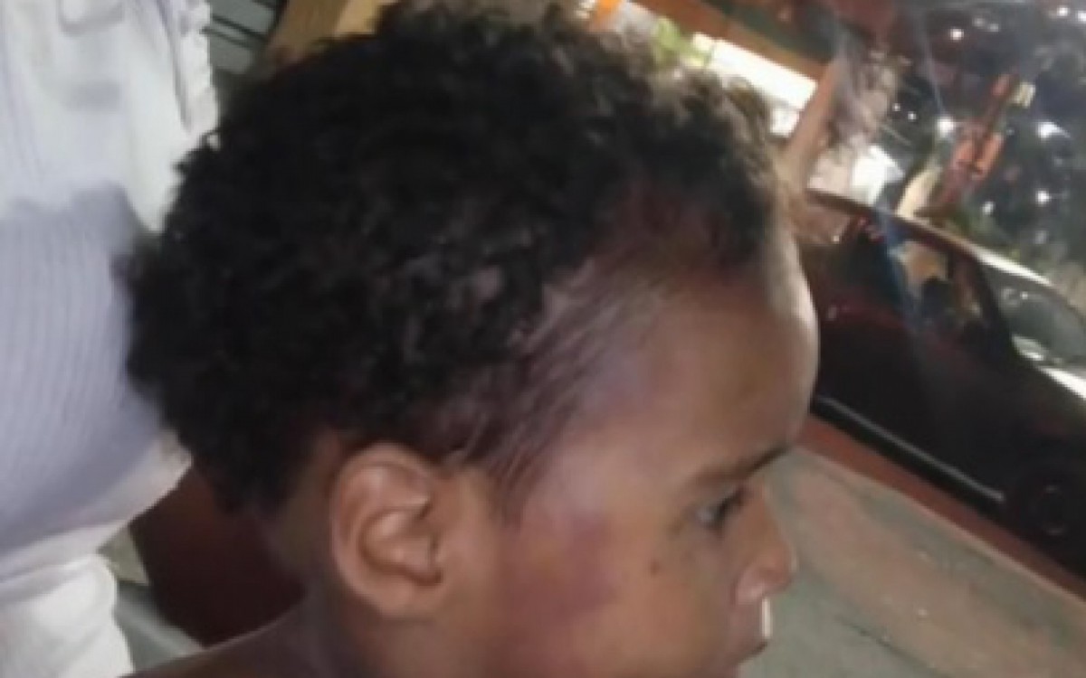 O laudo do IML aponta que a criança sofreu múltiplas agressões