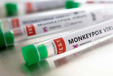 Organização Mundial da Saúde declara emergência internacional para conter surto da varíola de macacos 