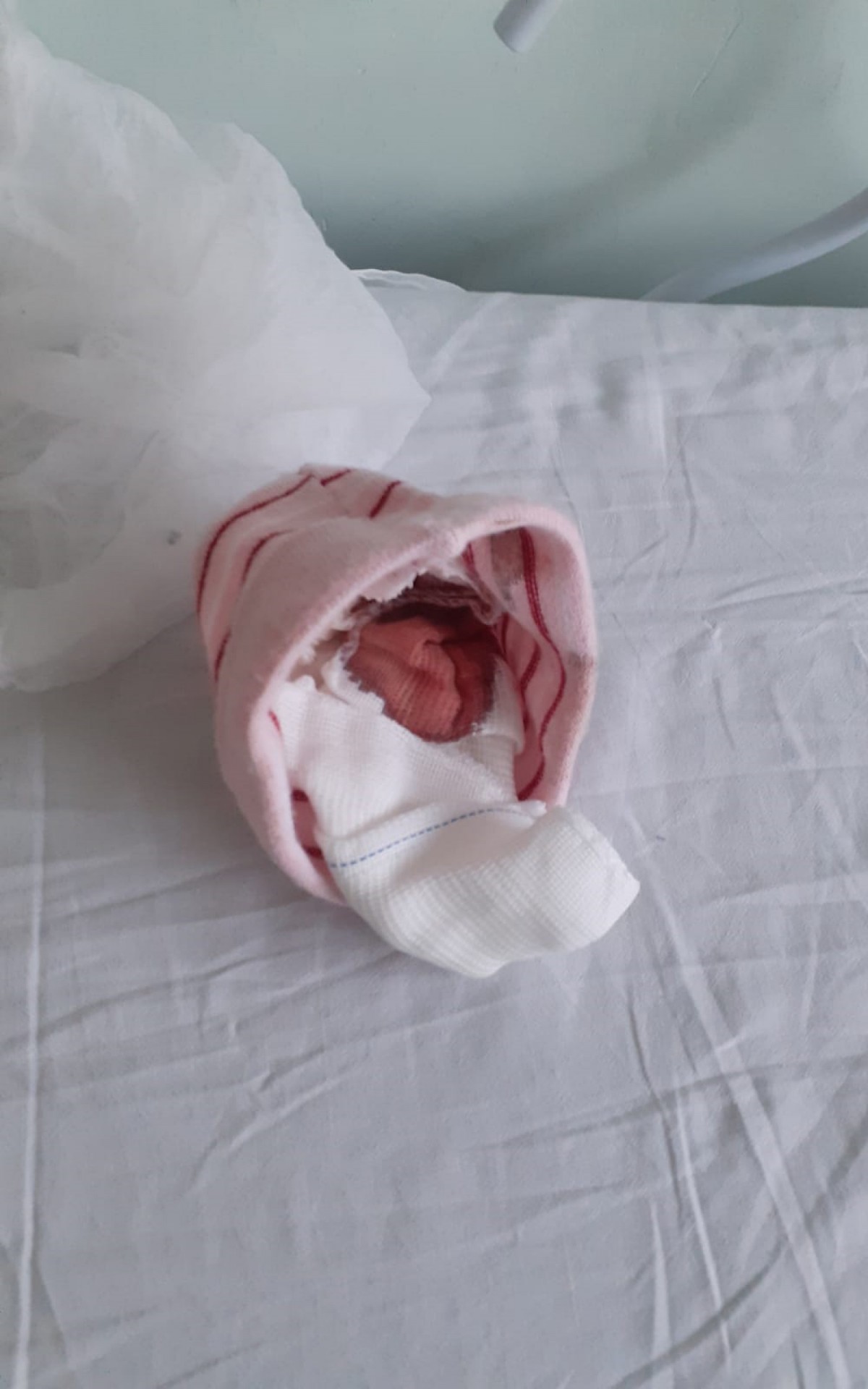 Ferimento na cabeça teria sido causado durante a tentativa de parto natural