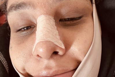 Linn da Quebrada mostra curativos após cirurgia de afirmação de gênero