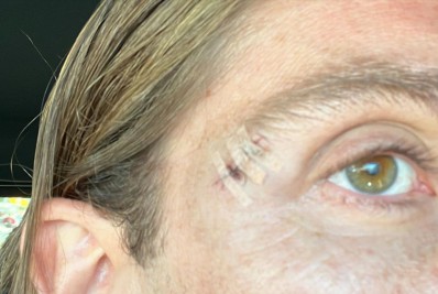 Vídeo: Filipe Luís sofre 'acidente' no treino do Flamengo e abre o supercílio