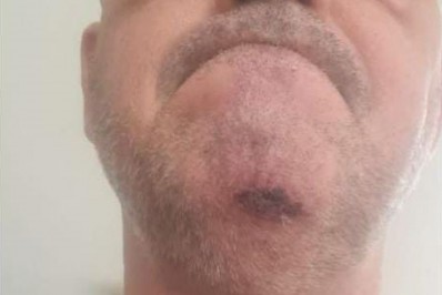 Belga morto por cônsul enviou foto de suposta agressão a irmão: 'Um inferno com Uwe'