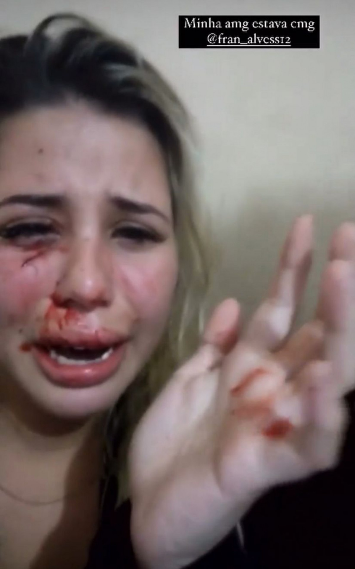 A influenciadora publicou uma série de vídeos em que mostra o rosto machucado devido as agressões sofridas pelo namorado - Rede Social