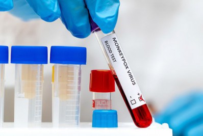 Rio receberá centro de testagem da varíola dos macacos ainda nesta semana