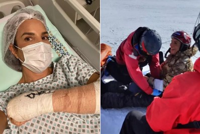 Ivete Sangalo publica vídeo de acidente com esqui: 'Dor insuportável'