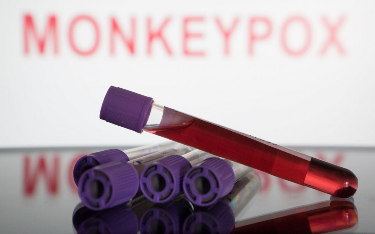 O pa&iacute;s acumula 3,1 mil casos da doen&ccedil;a, espalhados por 27 estados