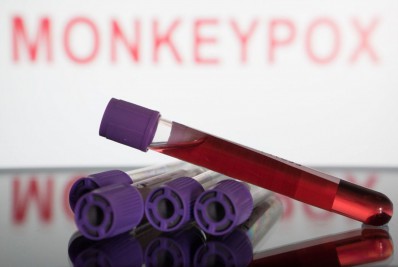 Brasil faz quase 9 mil testes de varíola dos macacos