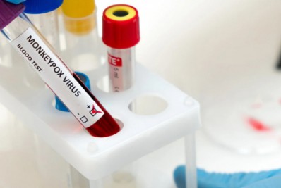 Porto Real confirma primeiro caso de varíola dos macacos