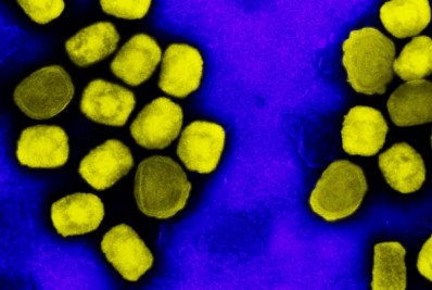 Rio tem 4.992 casos notificados de varíola dos macacos desde o início do surto da doença