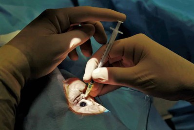 Búzios já aplicou mais injeções intravítreas que municípios com o dobro da população