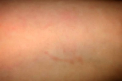 Manicure afirma ter sido agredida e abusada em ônibus por morar em 'comunidade rival'