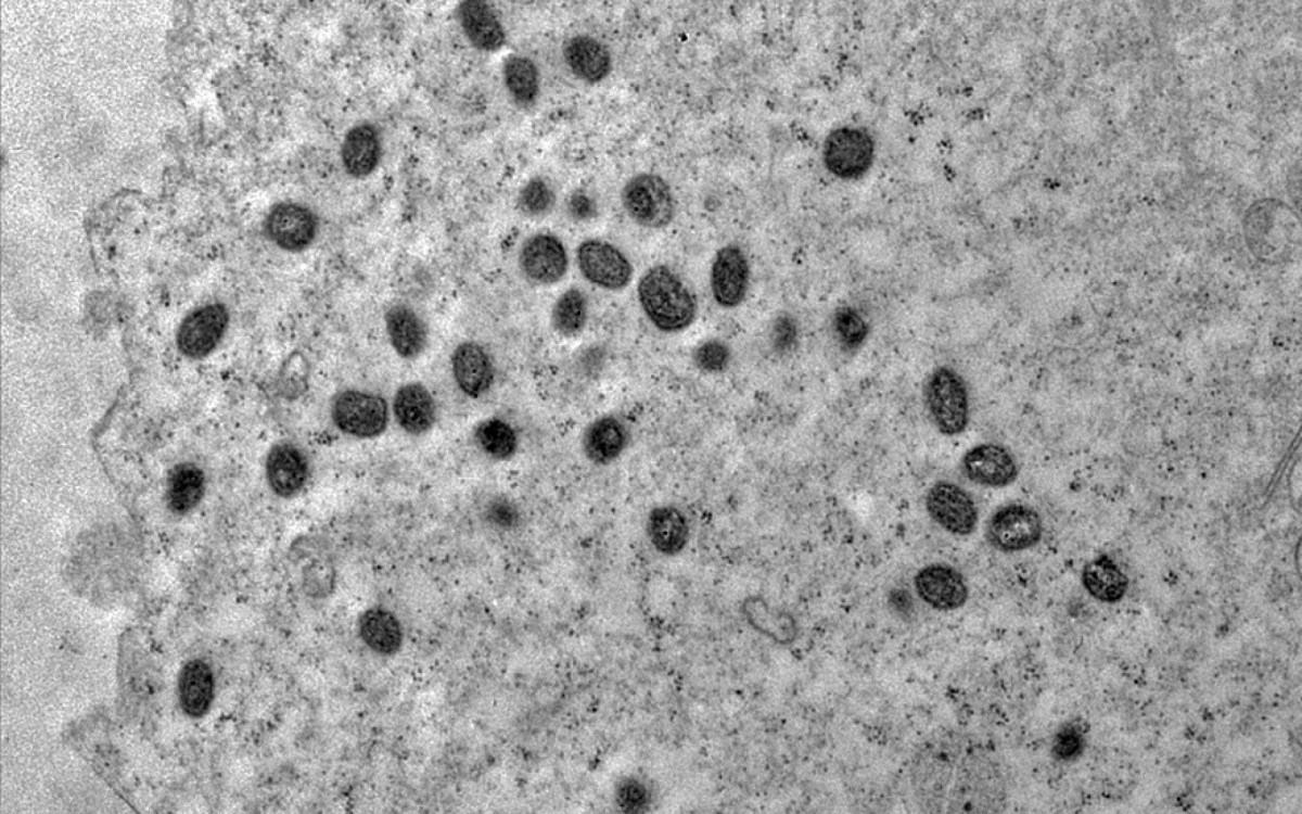 Partículas virais se replicam no interior da célula - Débora F. Barreto-Vieira/IOC/Fiocruz