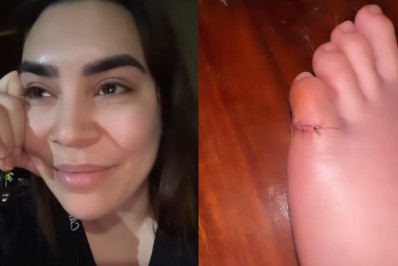 Naiara Azevedo pisa em faca e leva pontos no dedo: 'Me assustou'