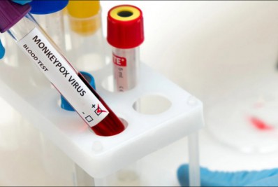 São Paulo confirma primeira morte por varíola dos macacos