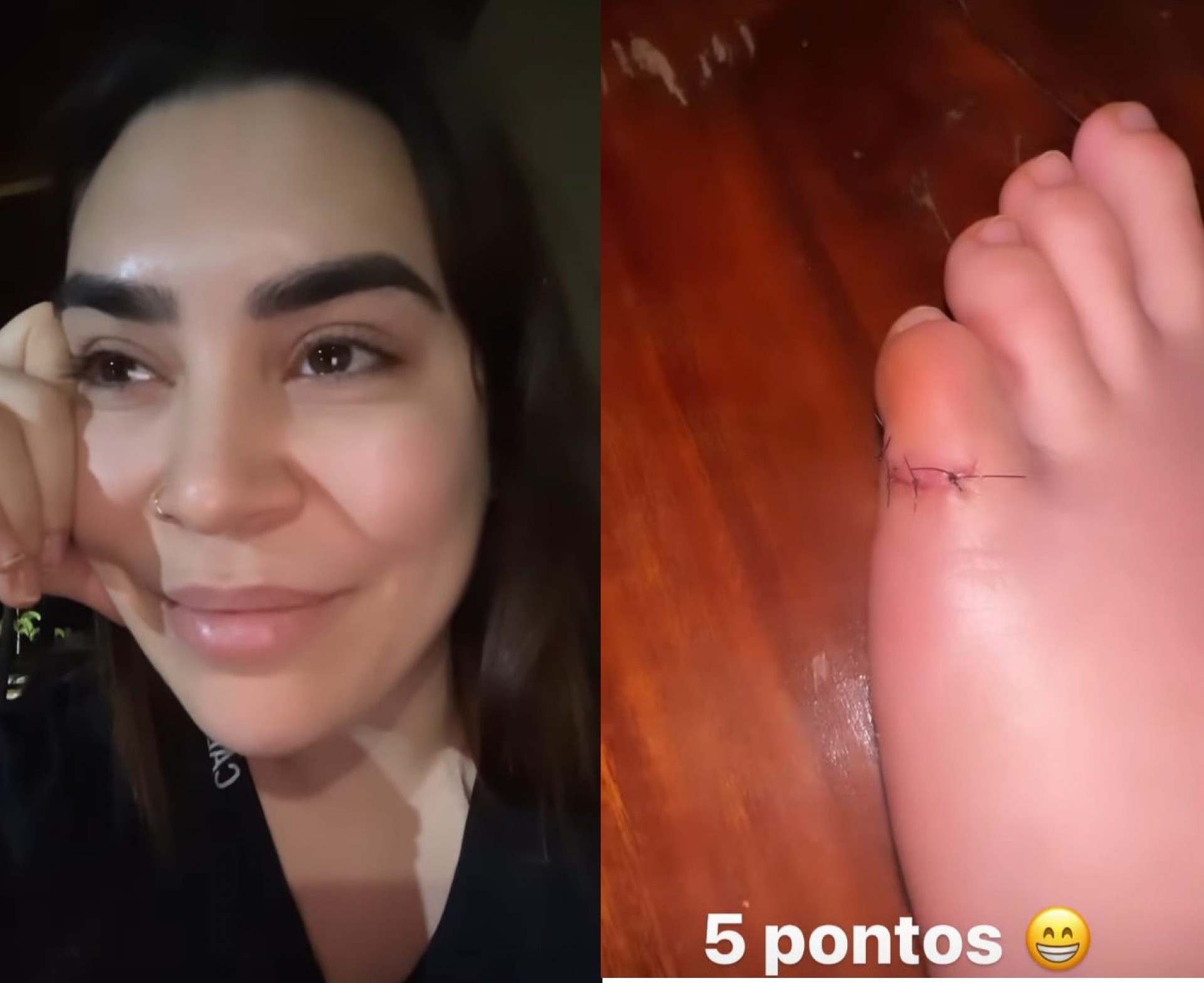 Naiara Azevedo levou 5 pontos ao pisar em faca  - Reprodução/Instagram 