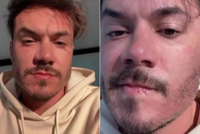 Eliezer realiza novo procedimento estético e manda recado para Viih Tube: 'Está gostando?'