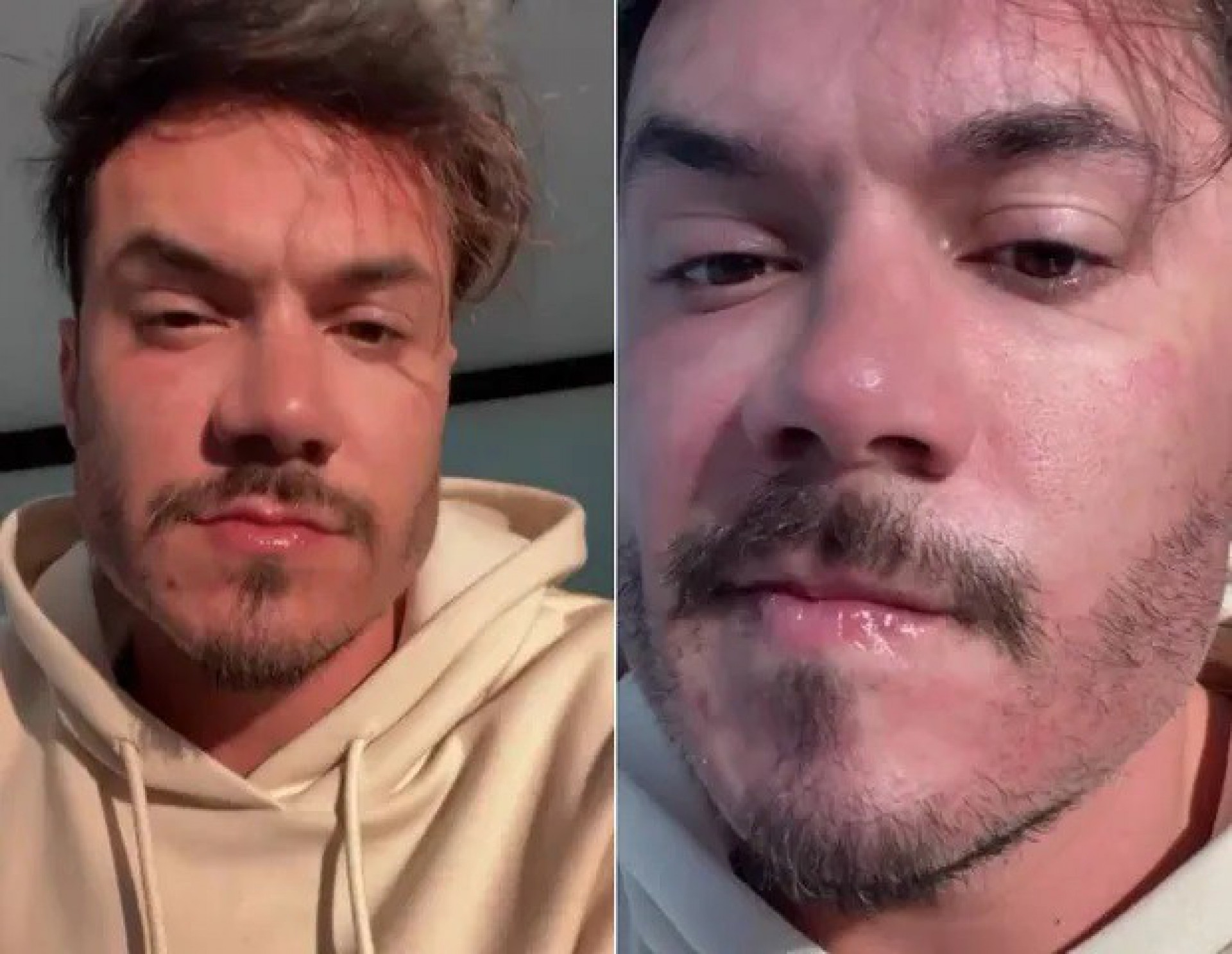 Eliezer realiza novo procedimento estético e manda recado para Viih Tube - Reprodução / Instagram