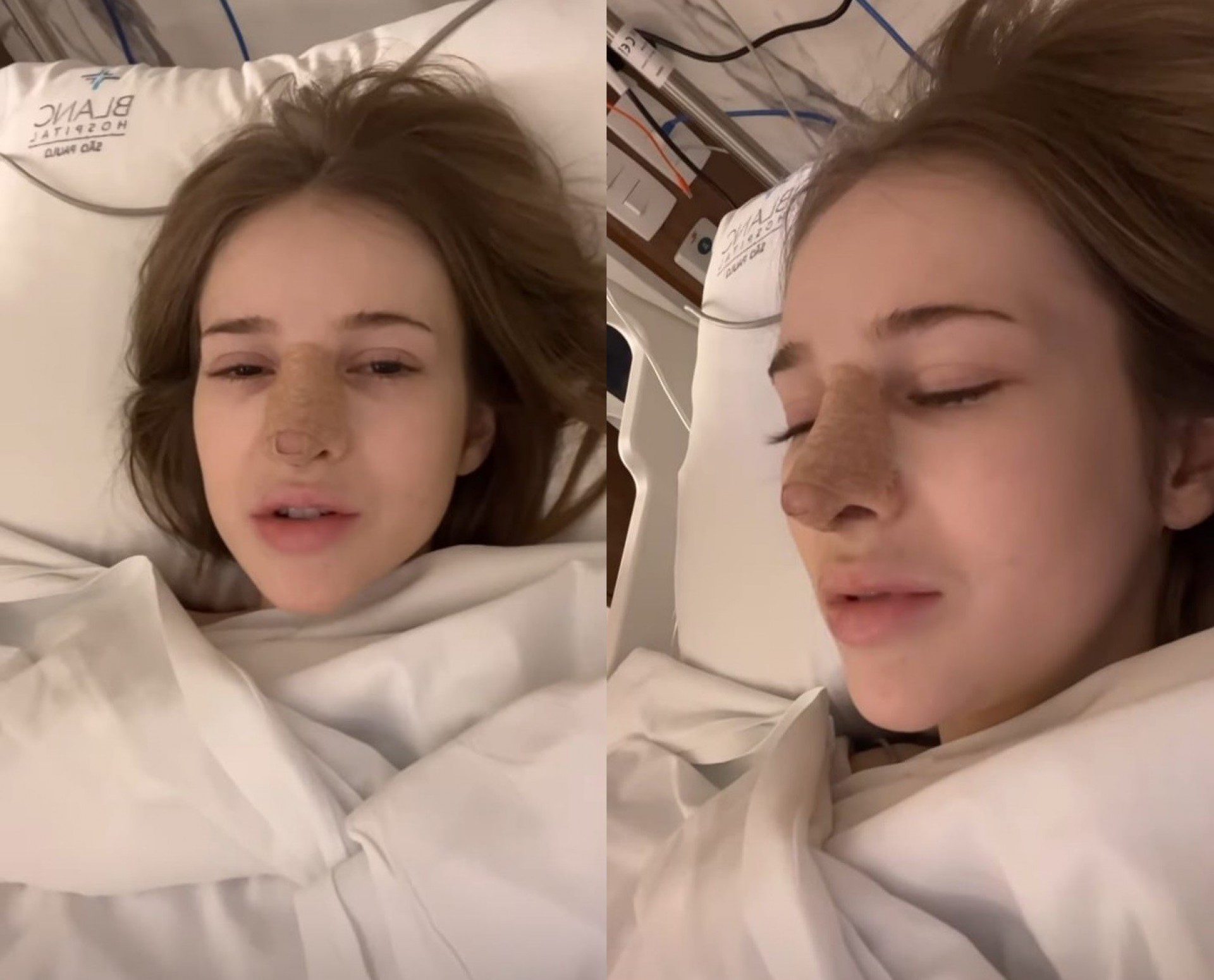 Sammy foi submetida a nova cirurgia no nariz  - Reprodução/Instagram 