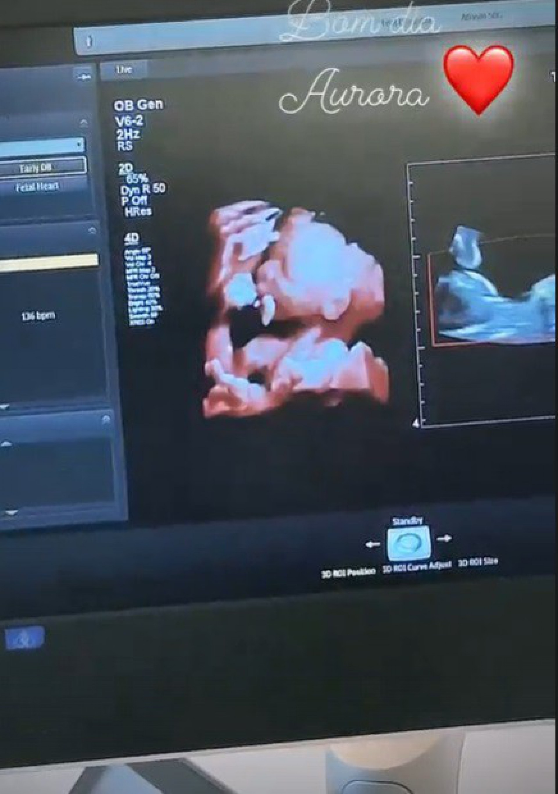 Pedro Scooby mostra imagens do ultrassom de Aurora - Reprodução do Instagram