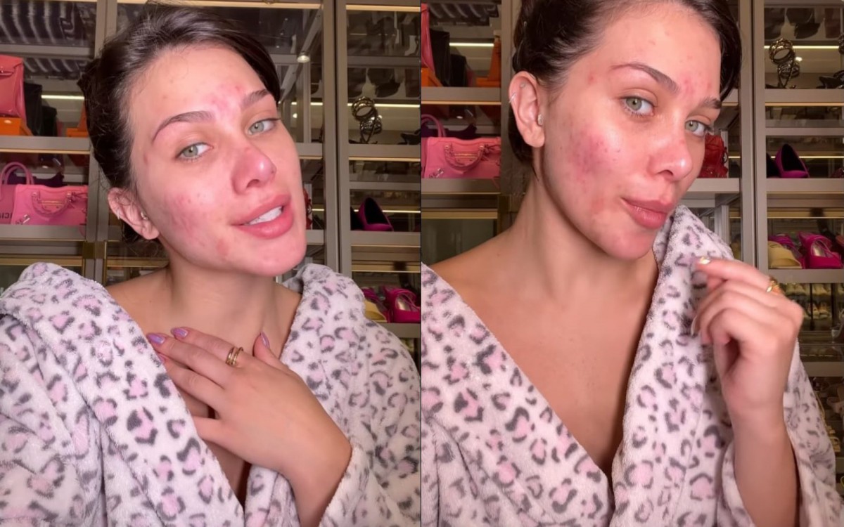 Atriz ensina tutorial perfeito para disfarçar acne com ajuda de