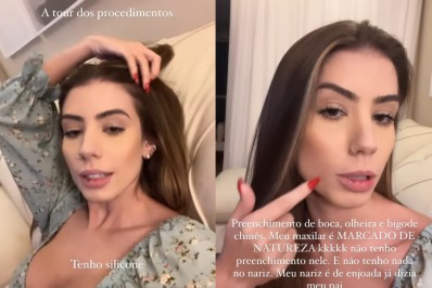 Maria Lina abre o jogo sobre procedimentos estéticos realizados