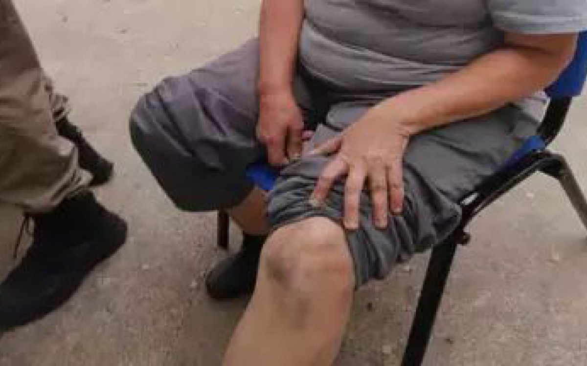 Lenice mostra joelho machucado