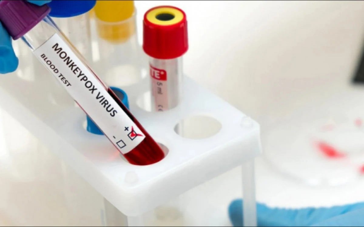 Saúde registra laboratorios para el diagnóstico de la viruela símica |  mundo y ciencia