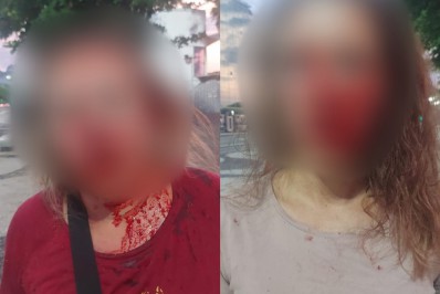 Turistas europeias são assaltadas e agredidas em Copacabana 