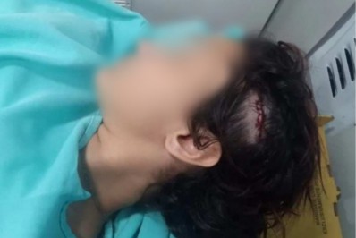 Homem que agrediu jovem a pauladas estava bêbado e ameaçou outras mulheres, dizem testemunhas