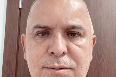 Orlando Morais fala sobre implante capilar: 'Estou feliz demais'