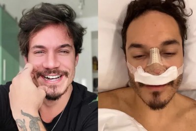Após rinoplastia, Eliezer tranquiliza seguidores: 'Deu tudo certo'