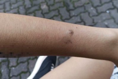 Mãe denuncia agressão de inspetor a estudante no Colégio Pedro II