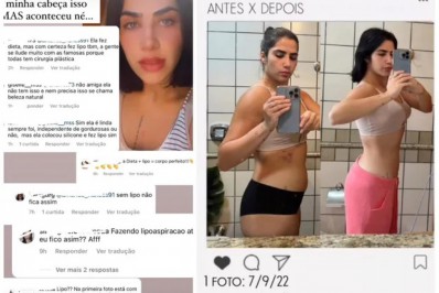 Jéssica Beatriz, filha do cantor Leonardo, rebate críticas após cirurgia plástica