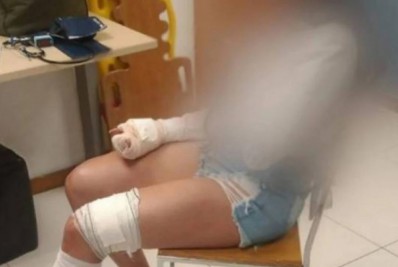 'Tive que segurar a faca para que ele não a enfiasse em mim', relata vítima de tentativa de assalto em shopping